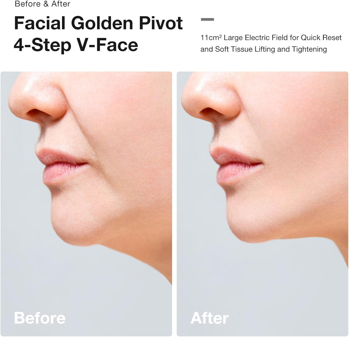 JOVS Slimax Full-Body Skin Care